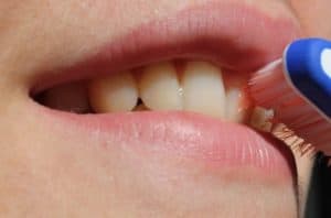Sensitive Teeth